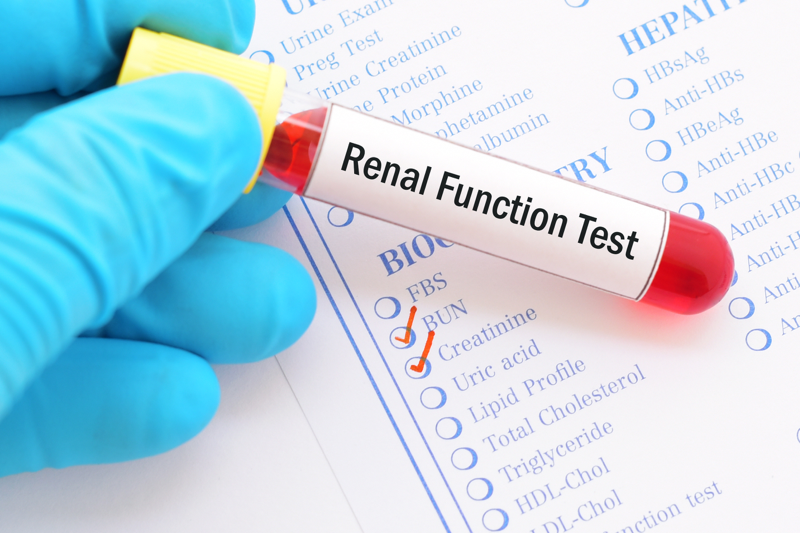 A vial with laboratory values related to the renal system